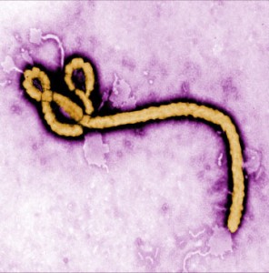 Ebola. Image courtesy US Centers for Disease Control and Prevention. 